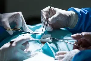Laparoscopic-Appendix-Surgery (1)