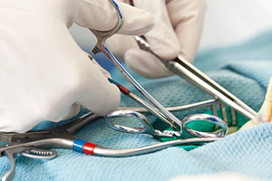 Laparoscopic-Appendix-Surgery