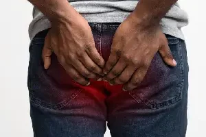 fitsula